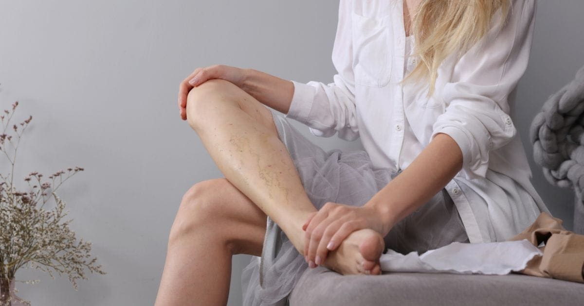donna che si massaggia le caviglie gonfie